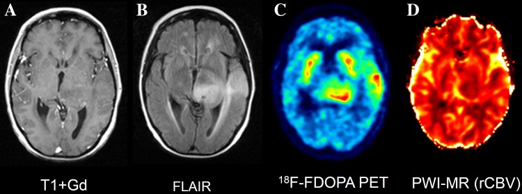 Fig. 4
