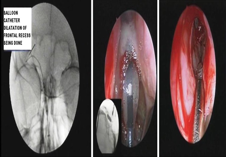 Fig. 3