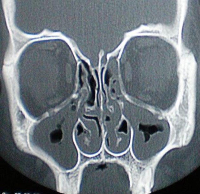 Fig. 1