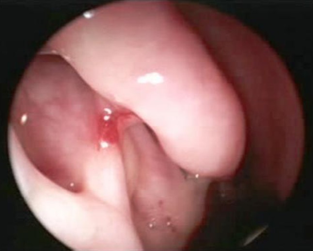 Fig. 4