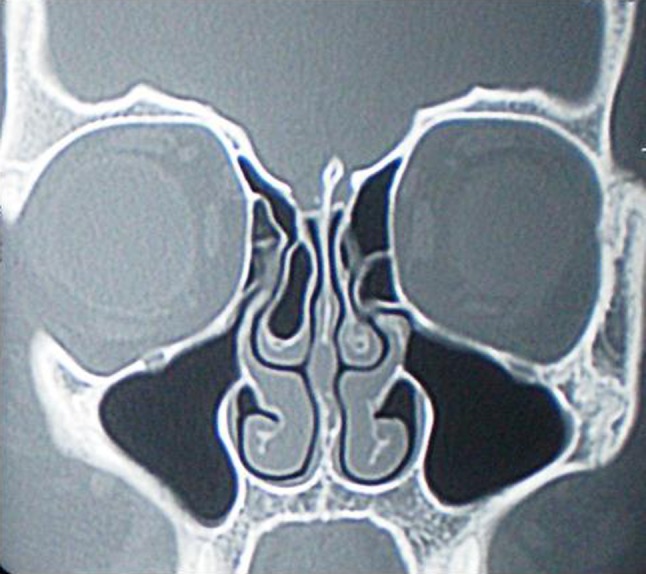 Fig. 5