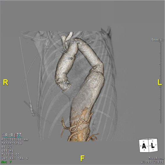 Figure 4.