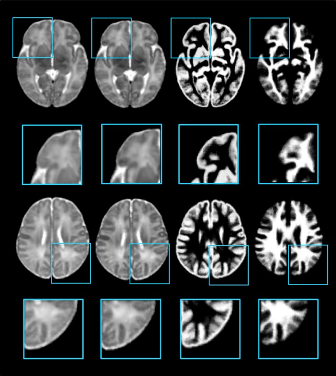 Figure 12