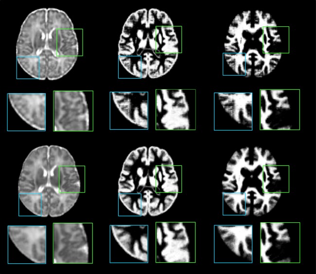 Figure 11