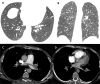 FIG 1