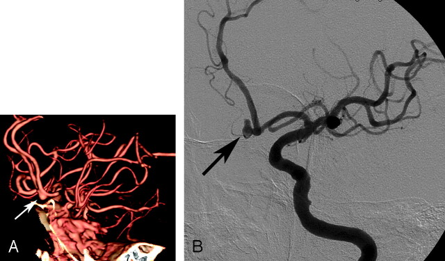 Fig 2.