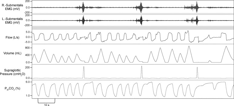 Fig. 1.