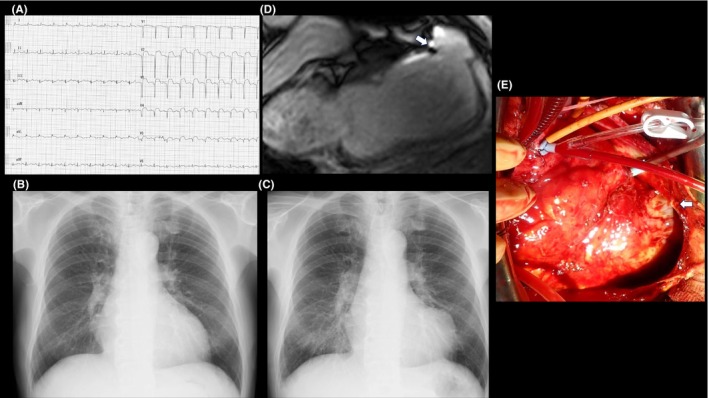 FIGURE 1