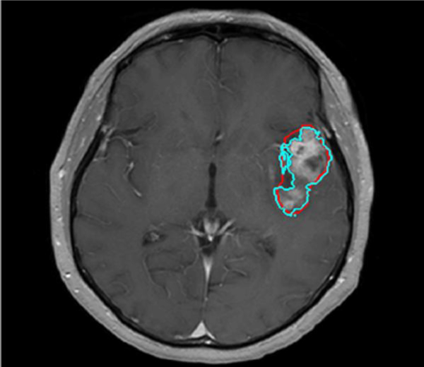 Fig 3.
