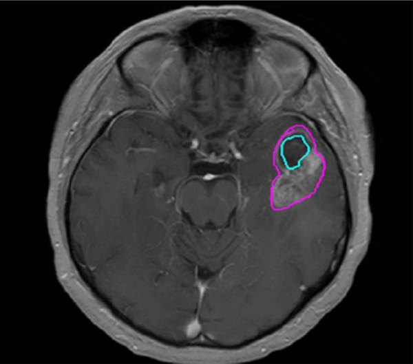Fig 2.