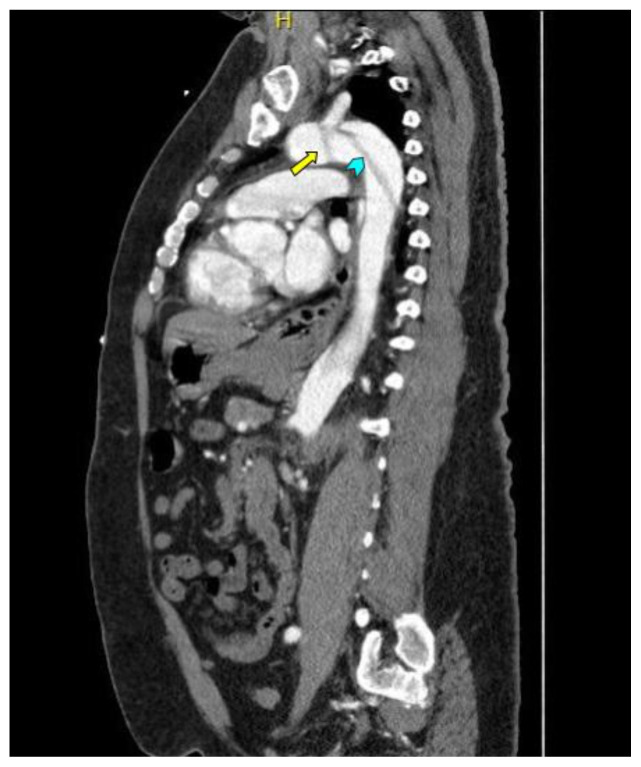 graphic file with name jetem-7-1-v13f7.jpg