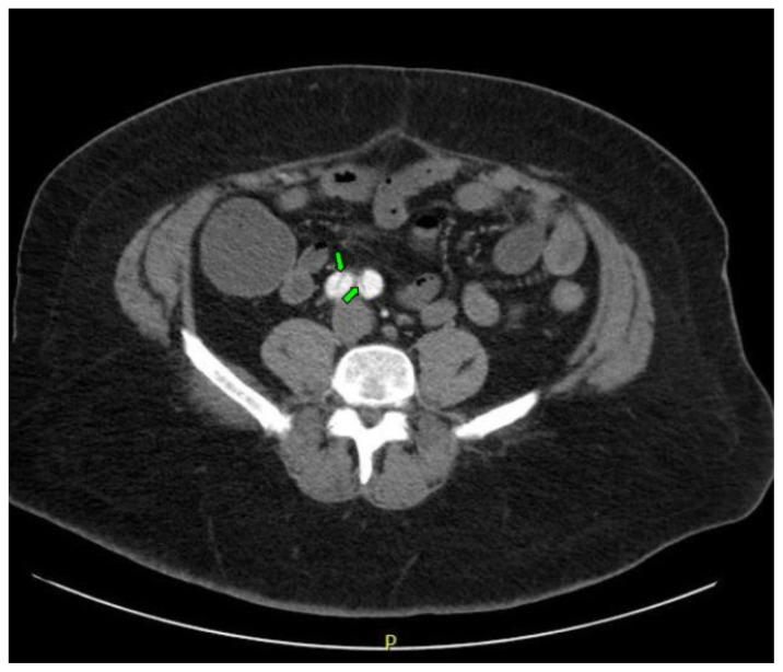 graphic file with name jetem-7-1-v13f5.jpg