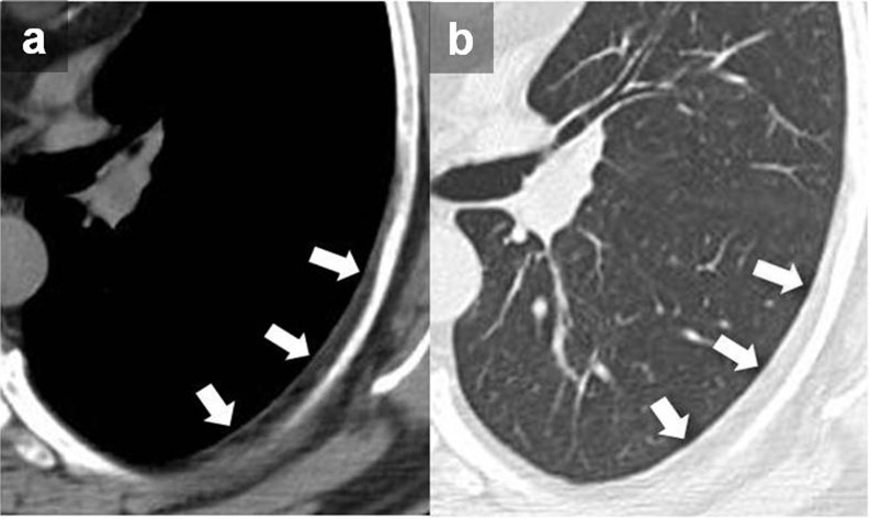 Figure 11.