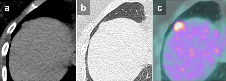 Figure 16.