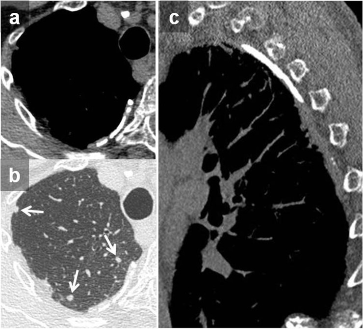 Figure 14.