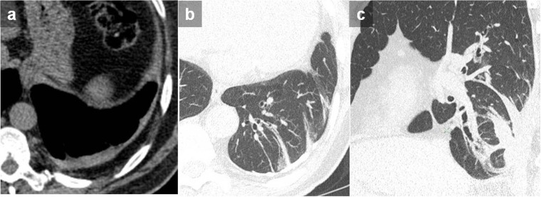 Figure 13.
