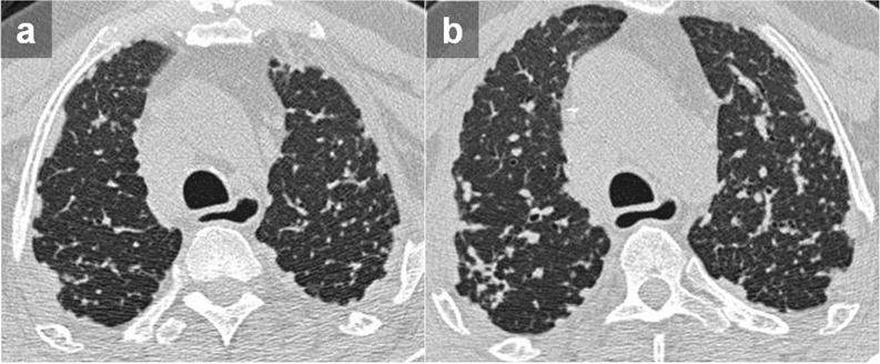 Figure 17.