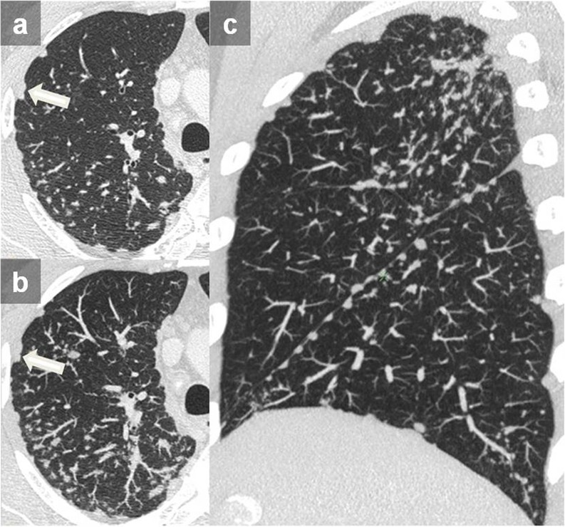 Figure 18.