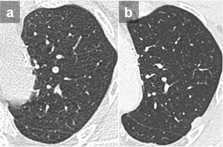 Figure 15.