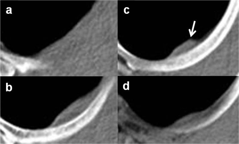 Figure 12.