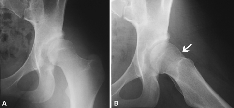 Fig. 3A–B