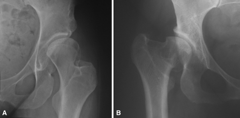 Fig. 2A–B