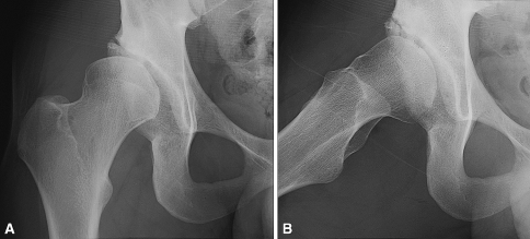 Fig. 4A–B