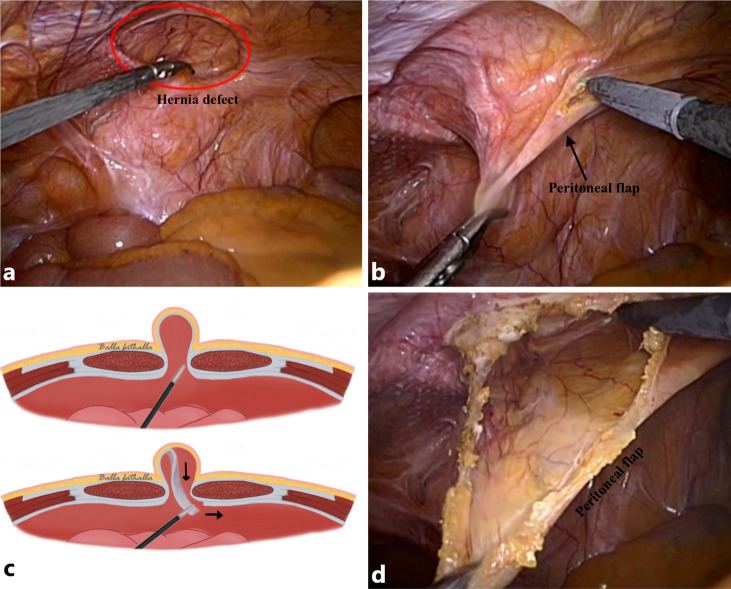 Fig. 4