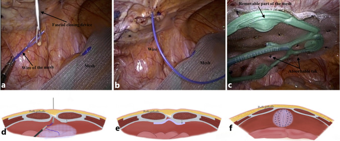 Fig. 6