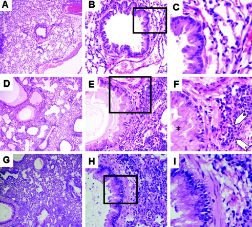 FIG. 11.