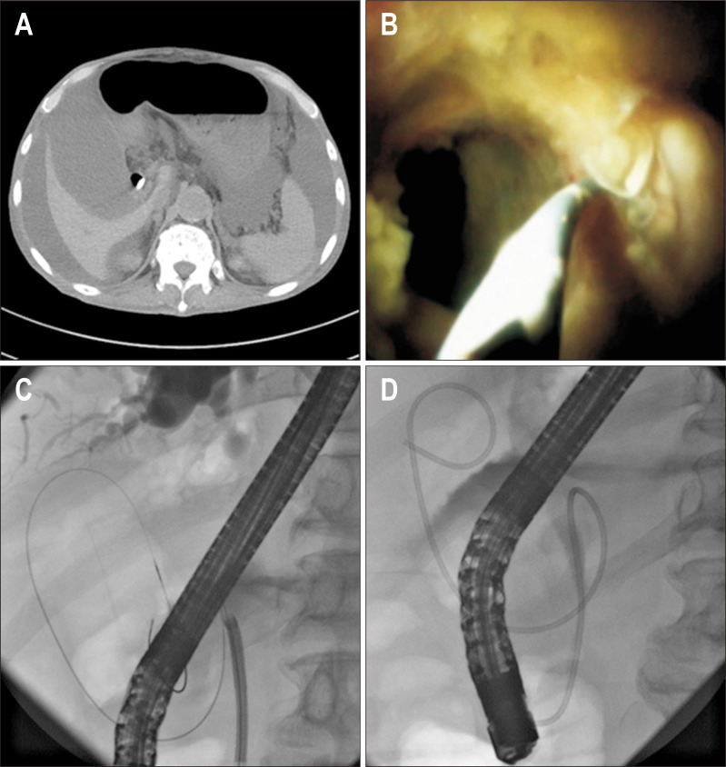 Fig. 1