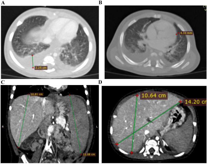 Figure 2