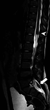 Fig. 33