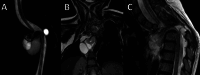 Fig. 12