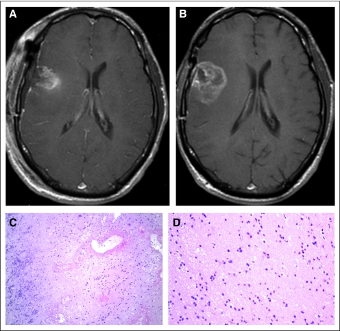 Fig 1.