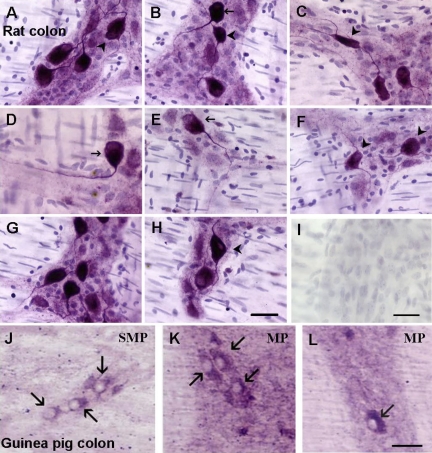 Fig. 12.