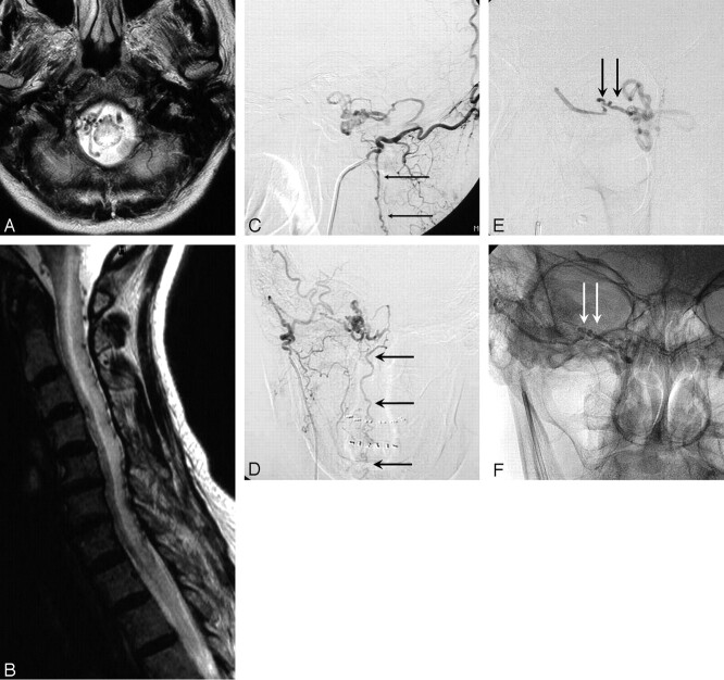 Fig 3.