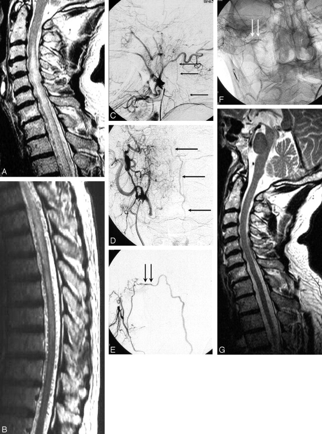 Fig 2.