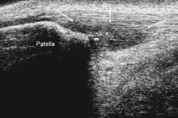 Fig. 5