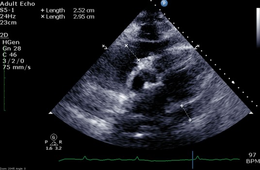 Fig 3.