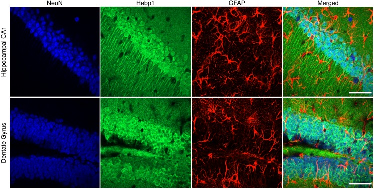 Figure 4—figure supplement 2.