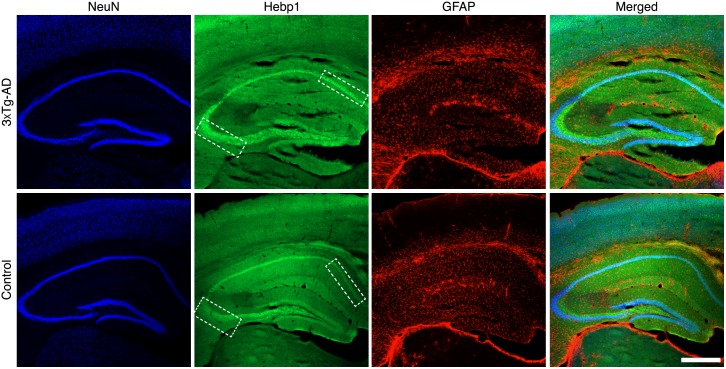 Figure 4—figure supplement 1.