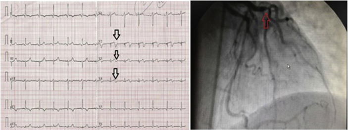 Fig. 2