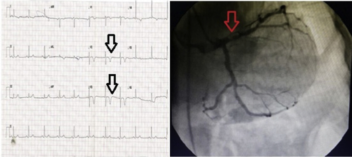 Fig. 1