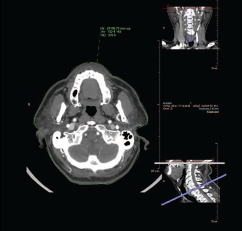 FIGURE 3