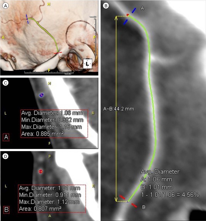 Fig. 2