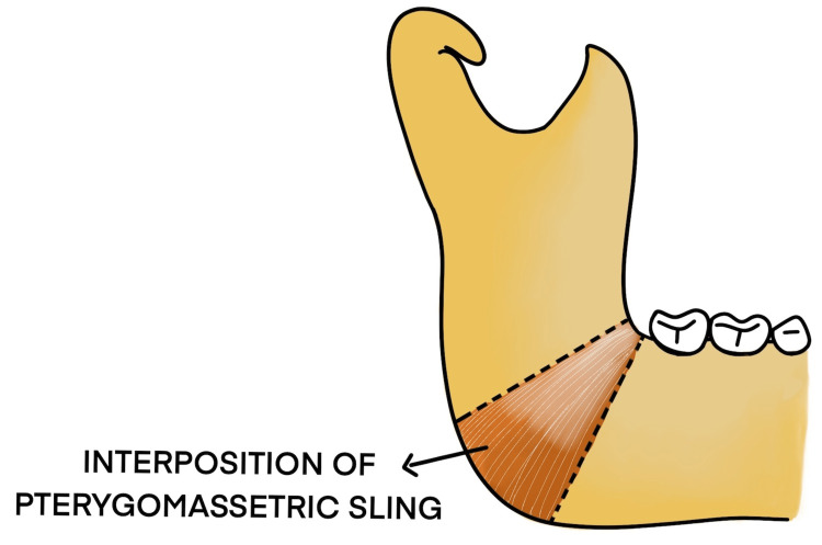 Figure 16