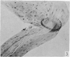 284-1