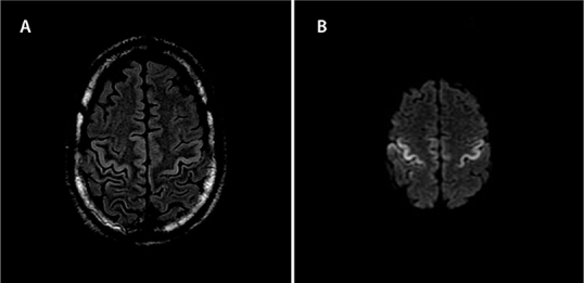 Figure 2: