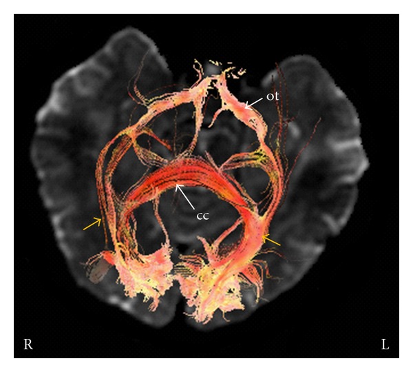 Figure 6